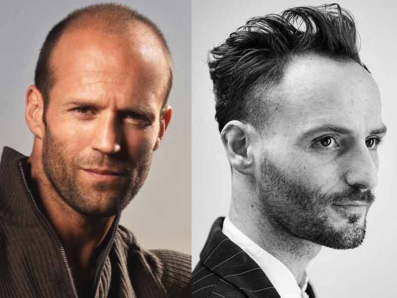 15 Best Hairstyles for Big Foreheads Male  Styles At Life