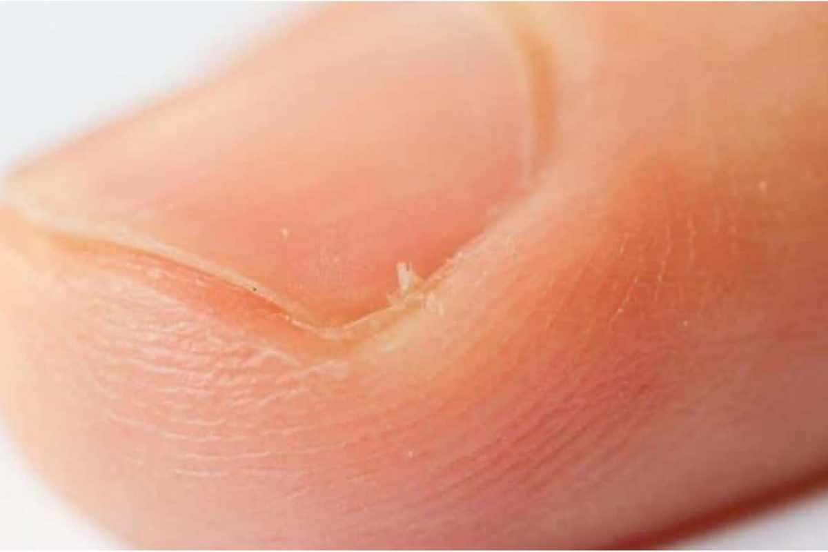 How to Get Rid of Hangnails and Prevent Them Hera Hair Beauty