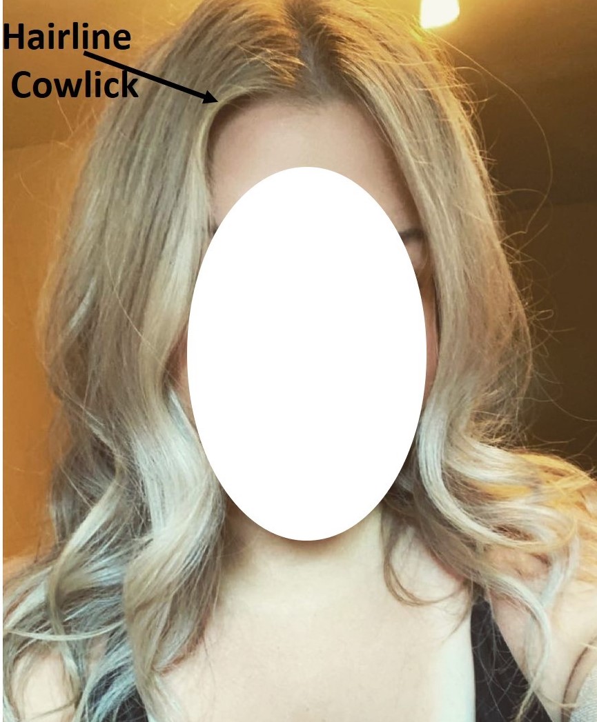 Do You Know Most of Us Have Cowlick in Our Hair? | Hera Hair Beauty